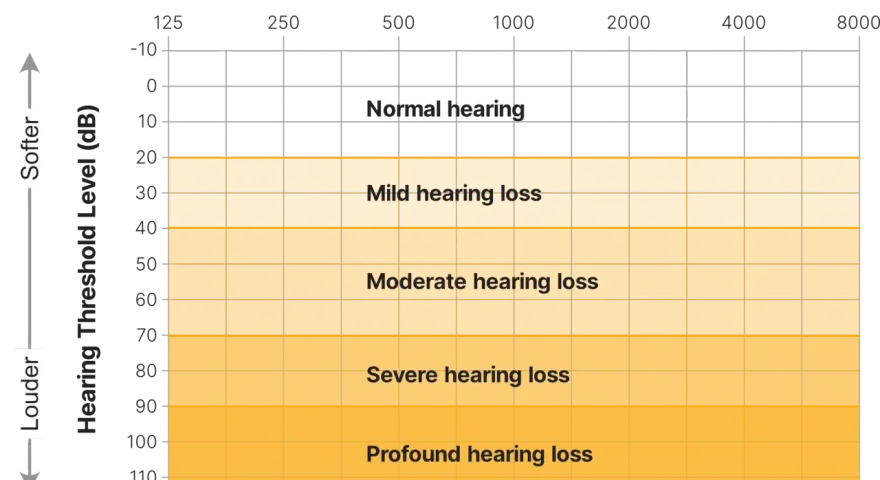 Graphique montrant les niveaux de perte auditive en fonction de la fréquence et du bruit decibel. De "normal hearing" à "profound hearing loss".