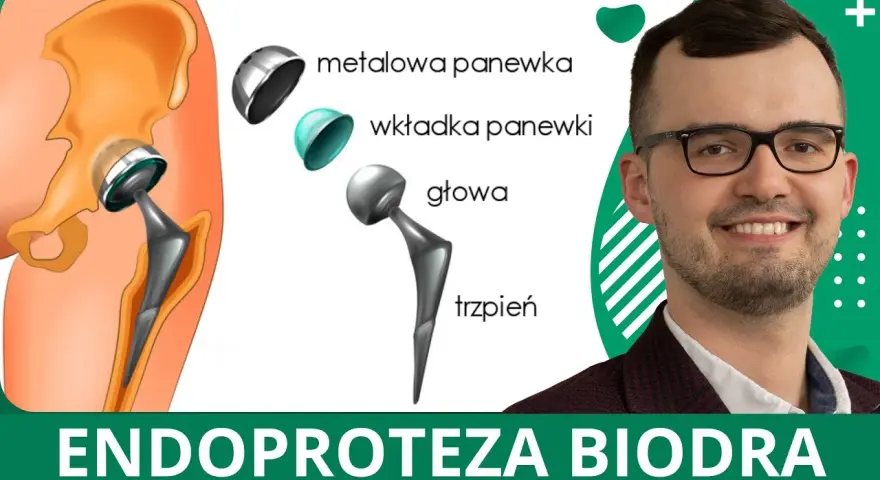 Jakie endoprotezy stawu biodrowego refunduje NFZ i ile kosztują?