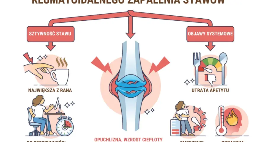 Wczesne objawy zapalenia stawów: sztywność, ból po bezczynności, opuchlizna, utrata apetytu, zmęczenie, gorączka.