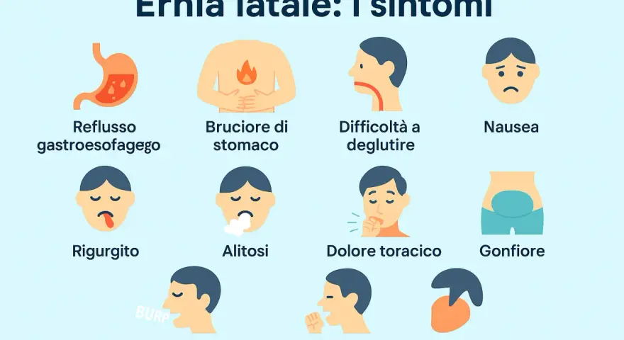 Sintomi dell'ernia iatale: reflusso, bruciore di stomaco, nausea, rigurgito, alitosi, eruttazioni, tosse secca, dolore toracico, gonfiore, difficoltà a deglutire e palpitazioni.