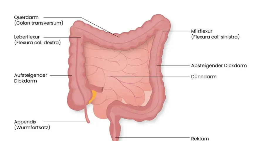 Der Aufbau des Darms: Dickdarm mit Querdarm, Leberflexur, aufsteigendem und absteigendem Dickdarm, Appendix, Rektum und dem zentralen Dünndarm.