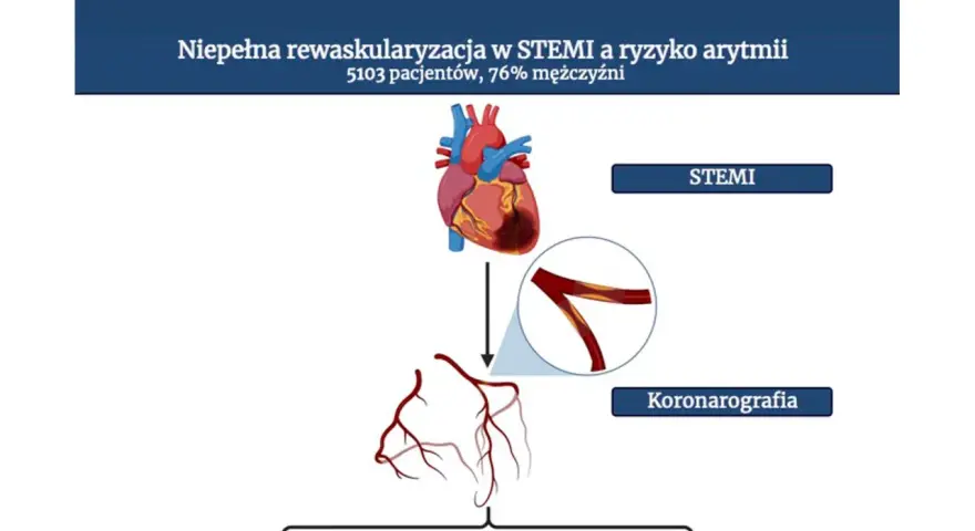 Ilustracja przedstawia serce, naczynia wieńcowe i schemat koronarografii.