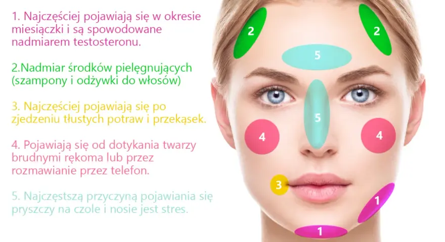 Dlaczego pryszcze wyskakują w tym samym miejscu? Sprawdź przyczyny