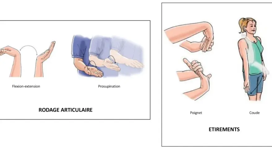 Exercices de mobilisation du poignet et du coude pour un épicondylite traitement naturel.