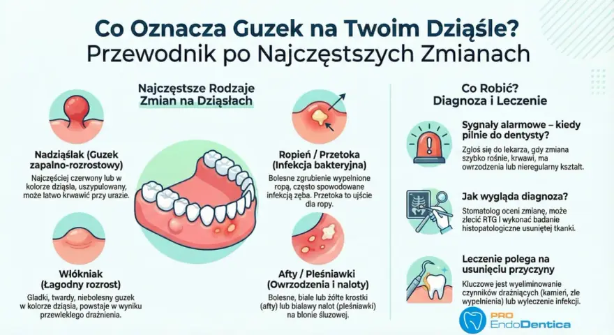 Guzek na dziąśle, ropień lub przetoka zębowa? Dowiedz się, co oznaczają zmiany i kiedy szukać pomocy. Domowe sposoby nie zawsze wystarczą.