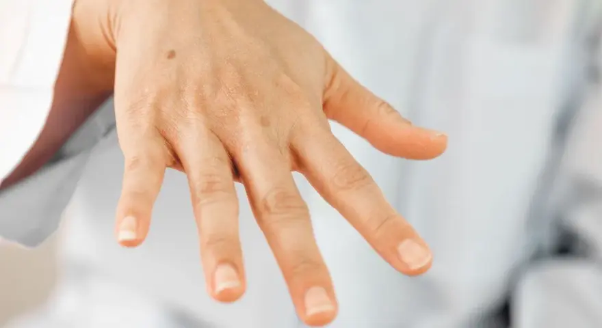 Una mano con algunas manchas, incluyendo un lunar visible en el dorso.