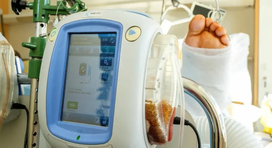 V.A.C.® Therapy Gerät mit gefülltem Behälter und einem Fuß im Verband. Die vac pumpe unterstützt die Wundheilung.