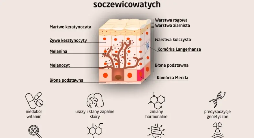 Schemat wyjaśnia, jak wyglądają plamy wątrobowe, pokazując budowę skóry i czynniki wpływające na powstawanie przebarwień.