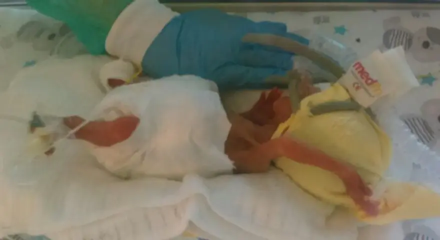 Maleńki noworodek, dziecko urodzone w 25 tygodniu ciąży, w inkubatorze, otoczony opieką medyczną.