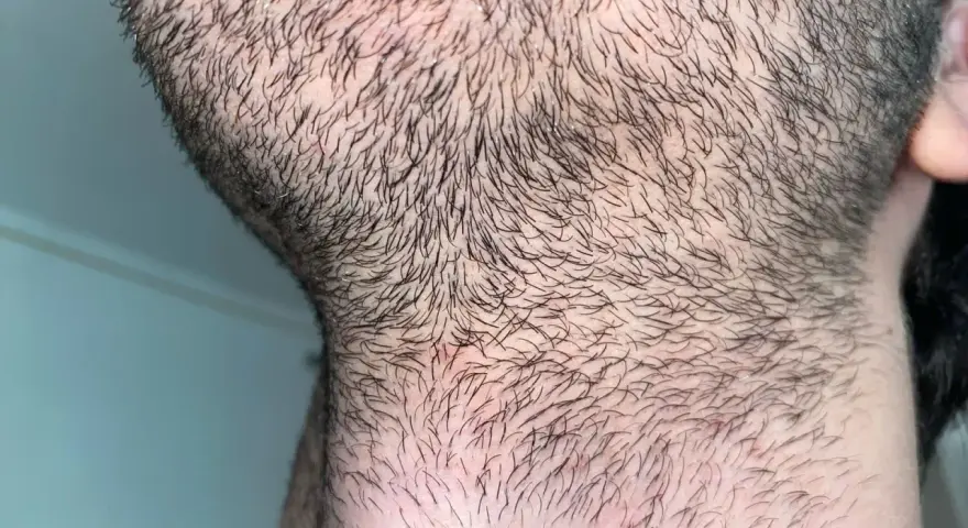 Barba incipiente y cuello con vello corto. Para una piel suave, es bueno afeitarse todos los días.