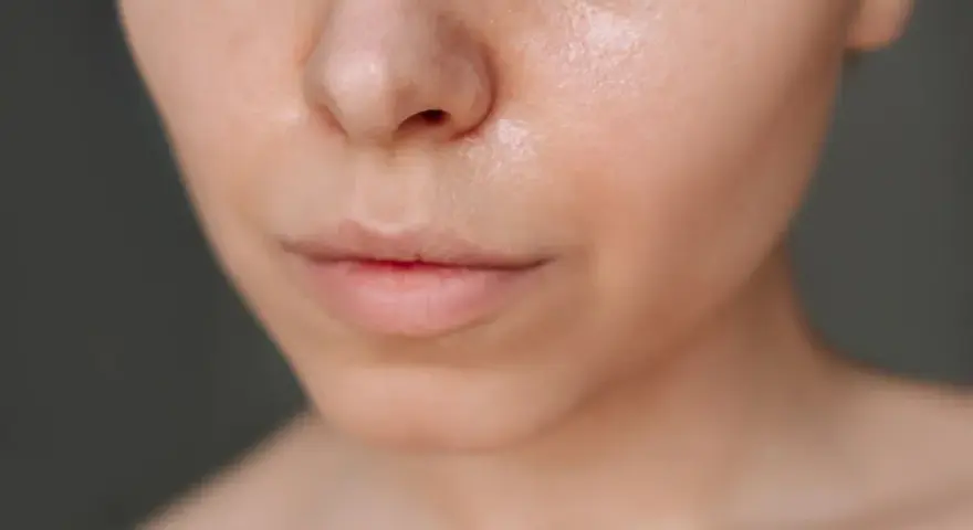 Nahaufnahme eines Gesichts, das zeigt, wie man fettige Haut pflegt. Die Haut glänzt leicht, was auf Feuchtigkeit hinweist.