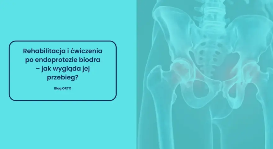 Rehabilitacja po endoprotezie biodra: Jak odzyskać pełną sprawność?