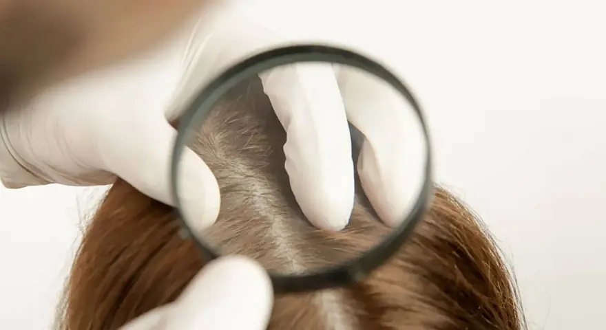 Wie viele Haare hat der Mensch? Die überraschende Antwort