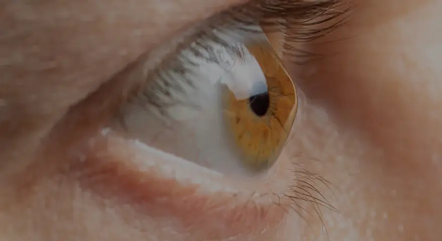 Occhio con iride ambrata e pupilla nera. La cornea deformata riflette la luce, creando un effetto visivo particolare.