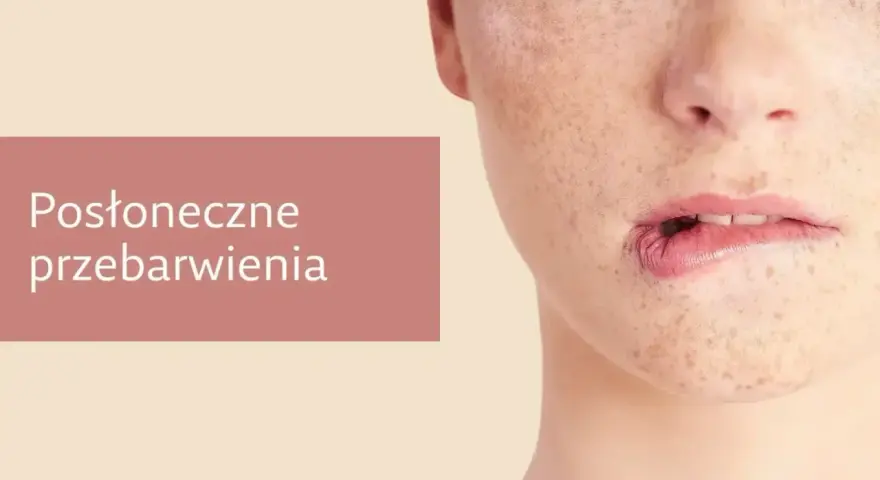 Jak poprawić koloryt cery? Widok zbliżenia na twarz z widocznymi przebarwieniami i piegami.