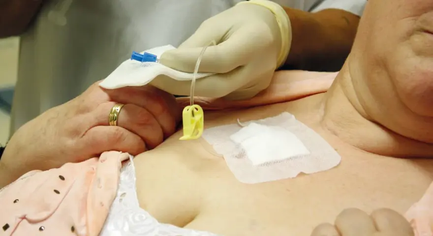 Eine Pflegekraft mit Handschuhen bereitet die Infusion an einem Port vene vor.