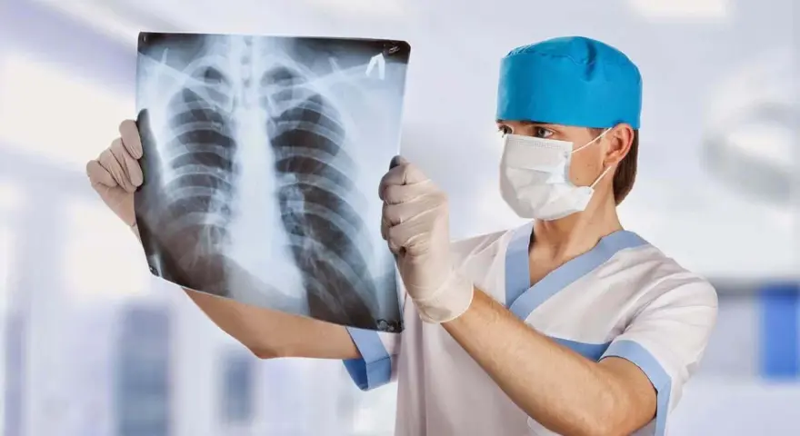 Un radiologo con mascherina e guanti esamina una radiografia del torace, analizzando attentamente ogni dettaglio per una diagnosi accurata.