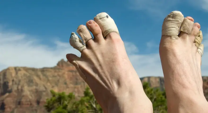 Zehen tapen wandern: Füße mit getapten Zehen ruhen nach einer langen Wanderung im Grand Canyon.