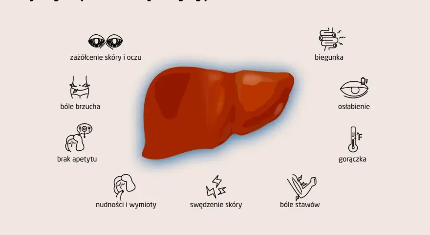 Objawy zapalenia wątroby typu A: zażółcenie skóry, bóle brzucha, brak apetytu, nudności, biegunka, osłabienie, gorączka, bóle stawów, swędzenie skóry.