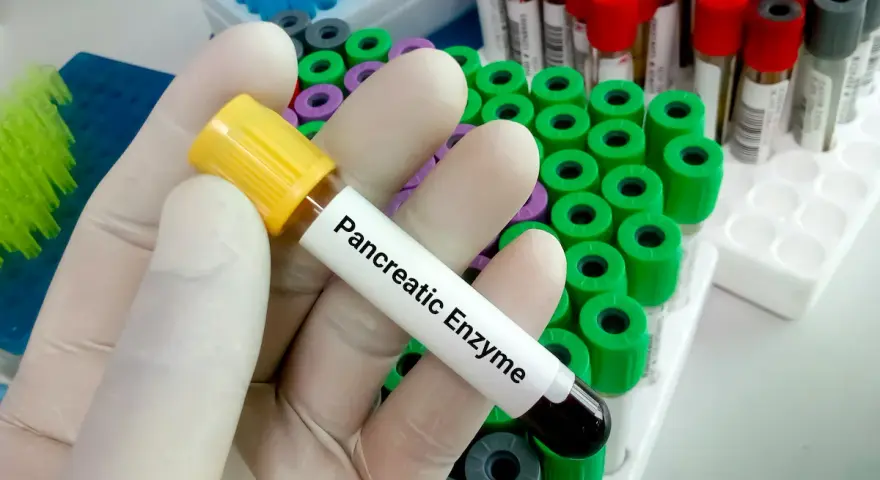 Ręka w rękawiczce trzyma probówkę z napisem "Pancreatic Enzyme", gotową do analizy. W tle widać wiele innych probówek.