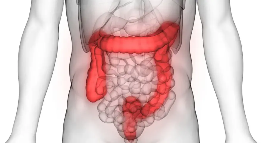 Anatomia jelita grubego podświetlona na czerwono na tle przezroczystego ciała ludzkiego.