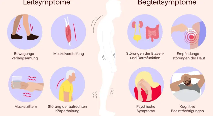 Die Grafik zeigt Leitsymptome wie verlangsamte Bewegung, Muskelsteifheit und Zittern, die auf eine Parkinson-Definition hinweisen. Begleitsymptome umfassen Blasen-/Darmstörungen, Hautempfindungsstörungen, psychische und kognitive Probleme.