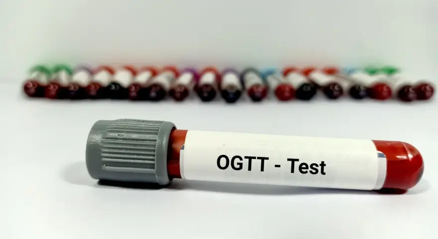 Probówki z krwią do badania OGTT - test obciążenia glukozą. W tle rząd innych próbek.