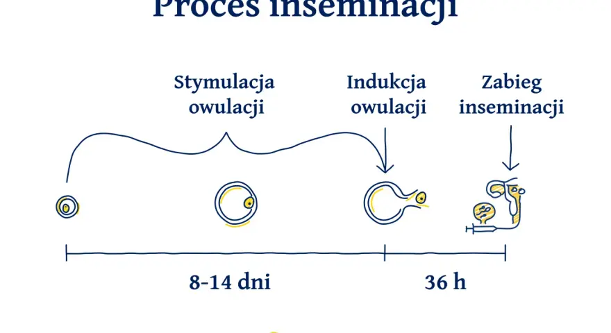 Schemat procesu inseminacji: od stymulacji owulacji (8-14 dni), przez indukcję owulacji, do zabiegu inseminacji (36 h).