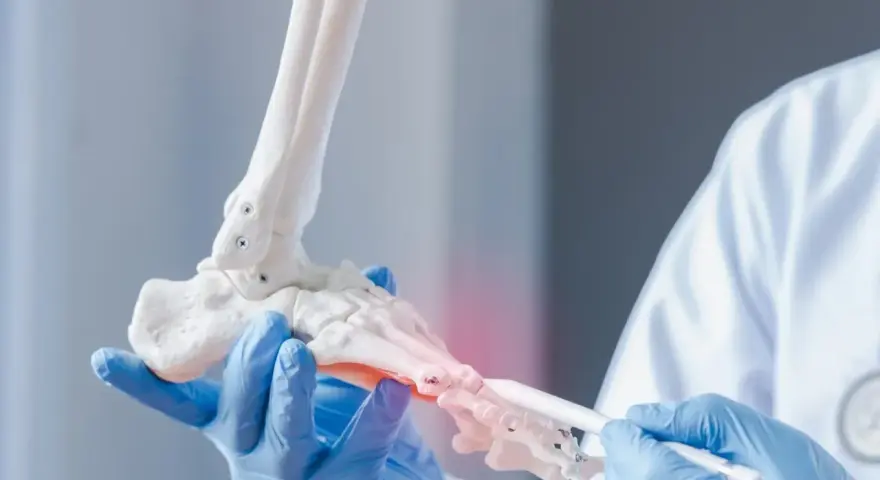 Kto wydaje skierowanie na badanie osteoporozy i jak je uzyskać?