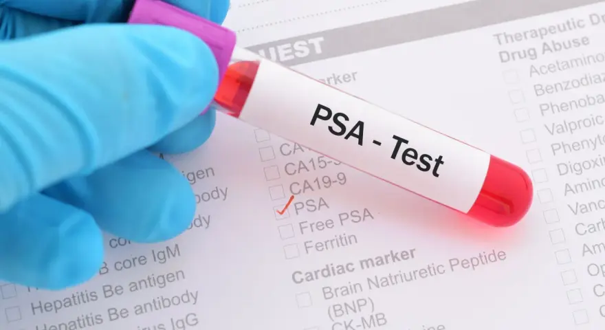 Rękawiczka w niebieskiej rękawiczce trzyma probówkę z krwią do testu PSA. Na formularzu zaznaczono PSA.