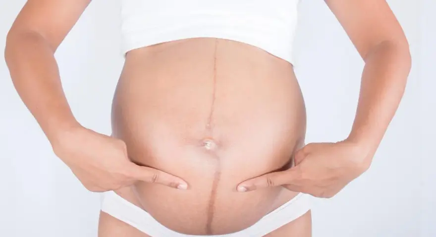 Ciemna linia, linea negra, biegnie przez brzuch ciężarnej kobiety, która wskazuje na nią palcami.