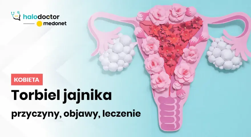 Jakie leki hormonalne na torbiel jajnika mogą skutecznie pomóc?