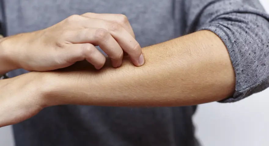 Juckende Haut am Arm, ein mögliches Symptom bei zu viel Zink.