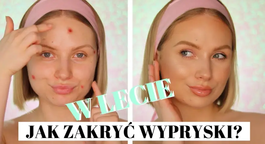 Jak zakryć pryszcze? Skuteczny makijaż krok po kroku