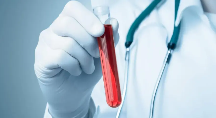 Rękawiczka z pipetą trzyma probówkę z czerwoną cieczą. Lekarz w białym kitlu i zielonym stetoskopie. Co to aptt?
