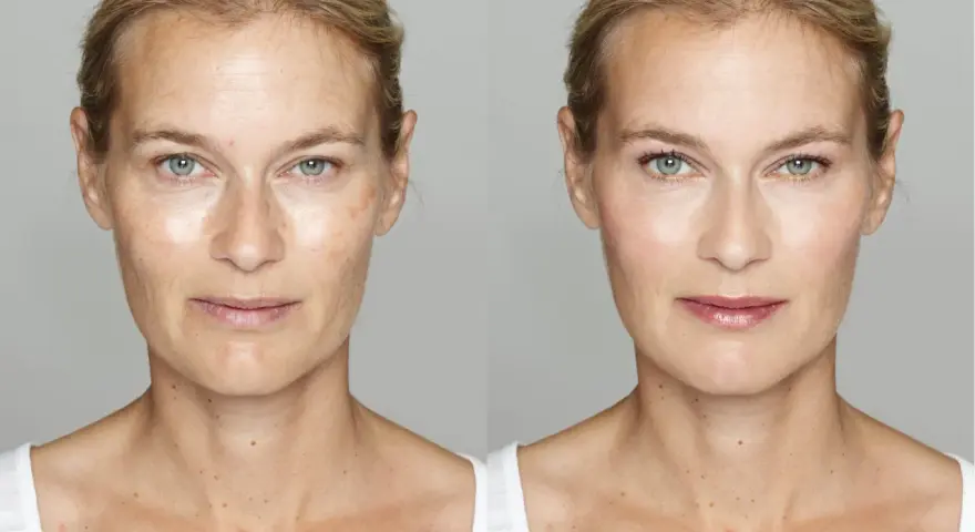 Before and after of a woman's face. The left side shows signs you are aging poorly: wrinkles, sun spots, and uneven skin tone. The right side shows a smoother, brighter complexion.
