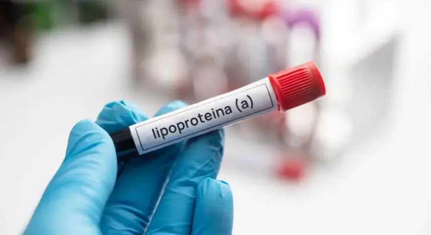 Ręka w niebieskiej rękawiczce trzyma probówkę z etykietą "lipoproteina (a)". Badanie poziomu tej lipoproteiny jest ważne.