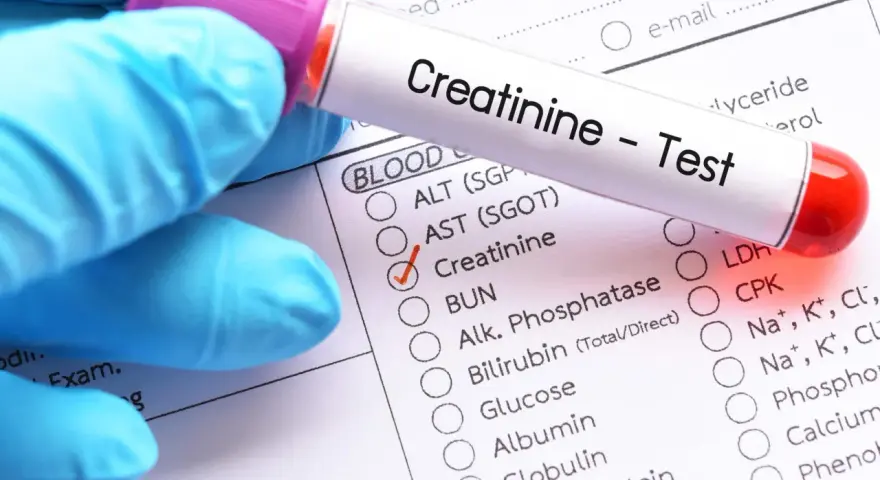 Rękawiczka w niebieskiej rękawiczce trzyma probówkę z napisem "Creatinine - Test". Zaznaczono pole "Creatinine", sugerując niski poziom kreatyniny.
