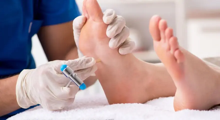 Badanie neurologiczne stopy, sprawdzanie odruchu Babińskiego za pomocą młoteczka.