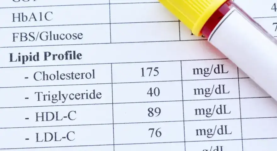 Wyniki lipidogramu: cholesterol 175 mg/dL. Zbyt niski cholesterol całkowity objawy mogą być subtelne, ale warto monitorować wyniki.