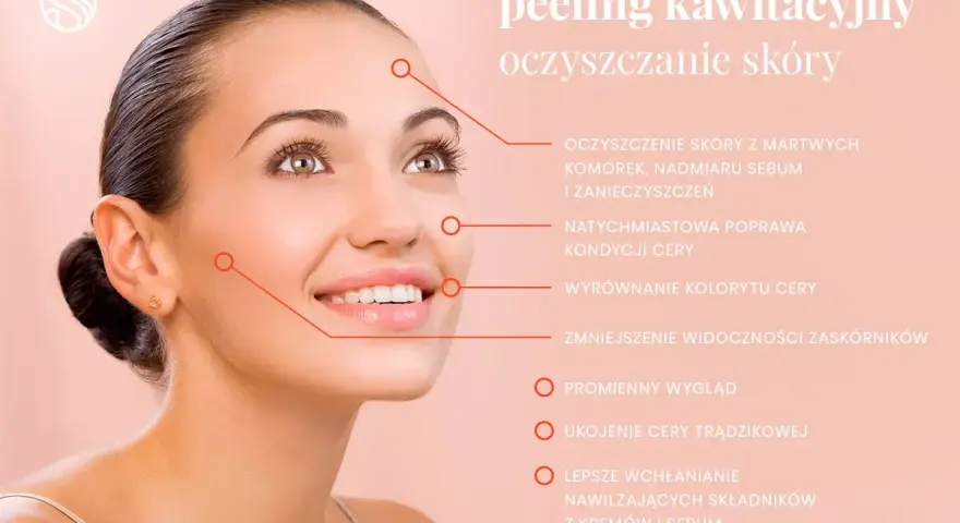 Uśmiechnięta kobieta z gładką cerą, której peeling kawitacyjny zapewnia głębokie oczyszczanie porów, redukcję zaskórników i promienny wygląd.