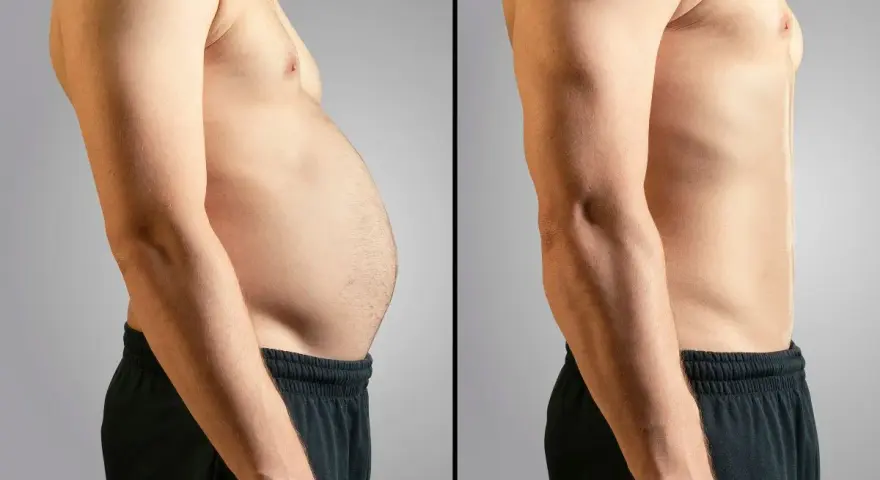 Antes y después: abdomen con grasa y abdomen tonificado. Un cambio radical para eliminar grasa abdominal.