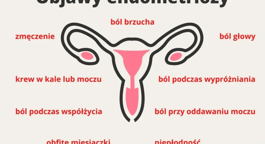 Objawy endometriozy: ból brzucha, zmęczenie, krew w kale/moczu, ból podczas współżycia, obfite miesiączki, ból głowy, ból podczas wypróżniania, ból przy oddawaniu moczu, niepłodność.