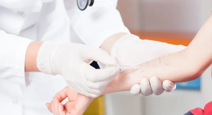 Lekarz w białej rękawiczce wykonuje test skórny na ramieniu pacjenta.