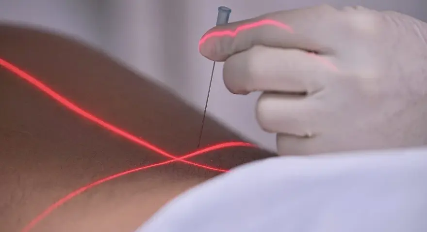 Eine Hand in einem Handschuh führt eine prt spritze unter rotem Laserlicht.