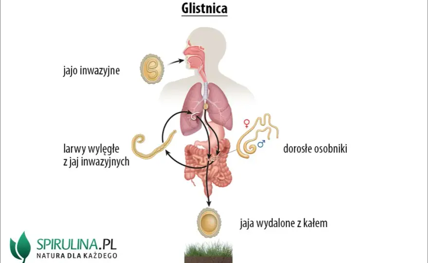Glistnica u dziecka: Kluczowe objawy, których nie możesz przegapić