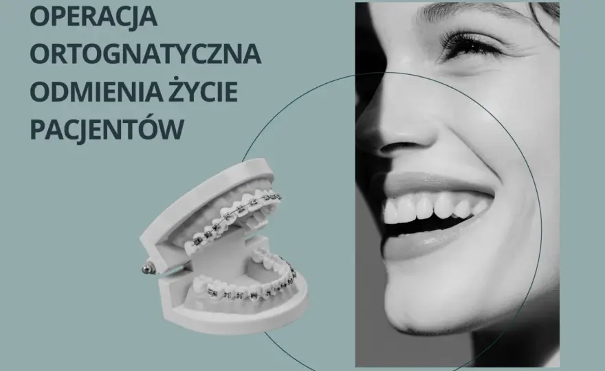 Operacja ortognatyczna - kiedy aparat nie wystarczy?