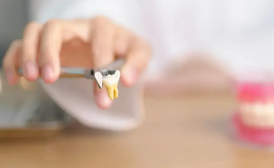 Denti mancanti a 40 anni - cause, cure e soluzioni
