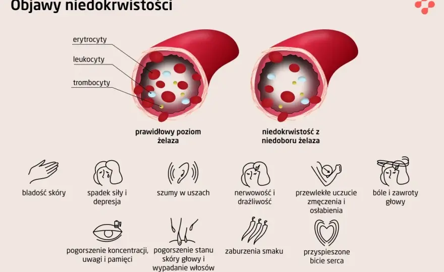 Żelazo we krwi - jak interpretować wyniki? Kompletny przewodnik