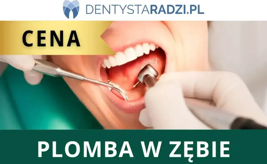 Ile kosztuje plomba? Pełny cennik i jak uniknąć niespodzianek!